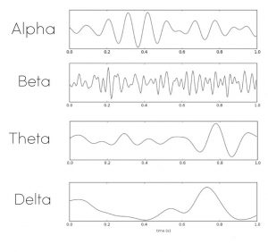 Ondas cerebrales e hipnosis: infografía de gamma, beta, alfa, theta y delta con frecuencias y estados mentales
